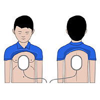ЕЛЕКТРОДИ для дітей AED Amoul S52-553 №2
