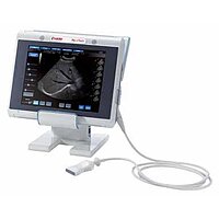 УЗД MyLab Touch Esaote