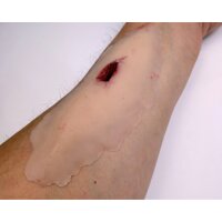 Рана колота S121-4597 №2