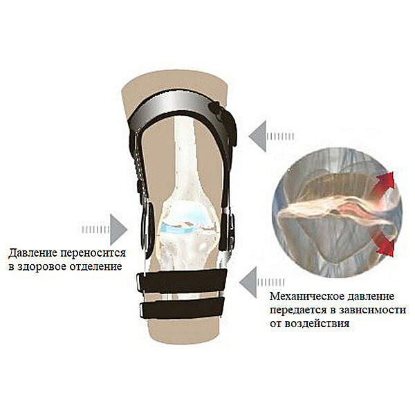 Ортез для колена Donjoy OA Nano 11-1214/5/6/7 (США)