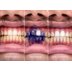 Корректор цвета зубьев SmileKit V34, 30 мл