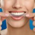 Отбеливающие полоски для зубов Crest 3D White Glamorous Whitestrips 14 упаковок, 28 полосок & Отбеливающая эмульсия Сrest Whitening Emulsions 10 g